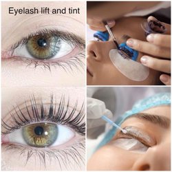 Shapes Of Eye