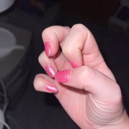 As seen here, my infected fingernail