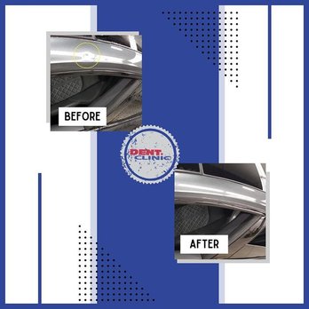 Dent Clinic - Dent Repair - Before & After - Auto Repair Near Me - Calgary, Alberta Dent Clinic - Dent Repair - Before & After - Auto Repair Near Me - Calgary, Alberta