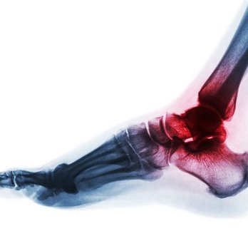 Naples Orthopedics - Orthopedists Near Me - Naples, Florida