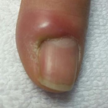 Strawberry Nails - Fair warning, gonna sue them!! - Nail Salons Near Me - San Jose, California