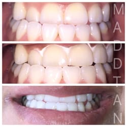 MaddTan - 1hr plant and mineral based whitening!
