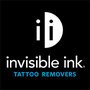 Photo of Invisible Ink Tattoo Removers