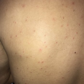 Irvine Spa - My back the next day after I Spa. - Day Spas Near Me - Irvine, California Irvine Spa - My back the next day after I Spa. - Day Spas Near Me - Irvine, California