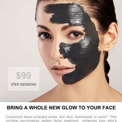 Lavish - Bring whole new glow to your face with the CARBON LASER FACIAL