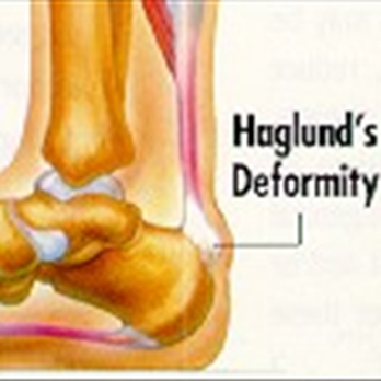 Ankle & Foot Associates - Podiatrists Near Me - Temple Terrace, Florida Ankle & Foot Associates - Podiatrists Near Me - Temple Terrace, Florida