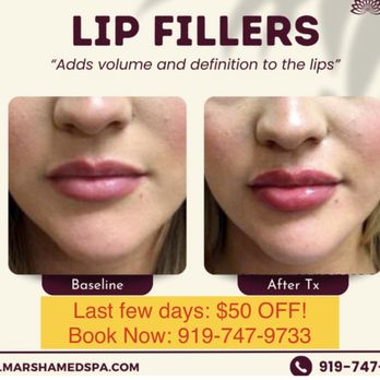 MarSha MedSpa - Medical Spas Near Me - Garner, North Carolina MarSha MedSpa - Medical Spas Near Me - Garner, North Carolina