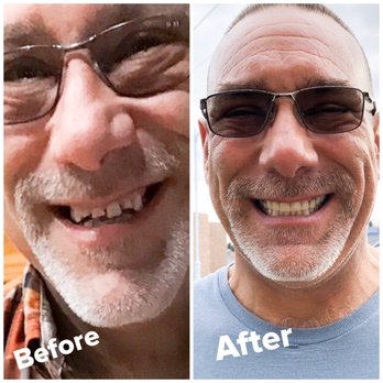 Arbor View Dental Group - Before and after. - General Dentistry Near Me - Roseville, California