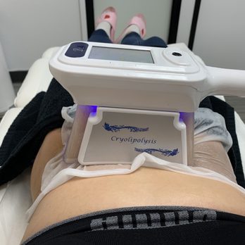 Flip Your Look - Cryoliplysis machine on tummy area - Medical Spas Near Me - Irvine, California