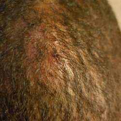 Faded Craft Barber Shop - Scalp