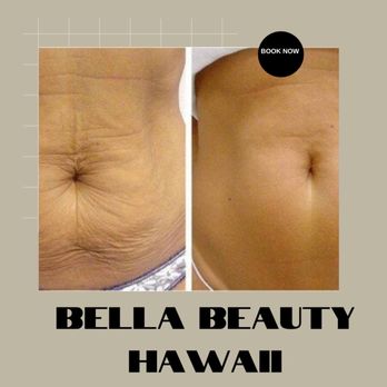 Bella Beauty - Body Contouring Near Me Bella Beauty - Body Contouring Near Me