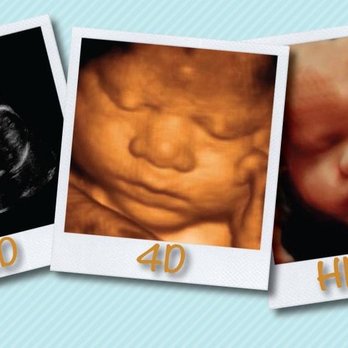 Oh Babee - Ultrasound Imaging Centers Near Me - Merced, California Oh Babee - Ultrasound Imaging Centers Near Me - Merced, California