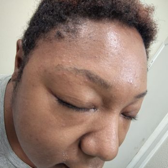 Mn Herbals Beauty - 3rd day my eyebrows are still irritated - Hair Salons Near Me - Citrus Heights, California