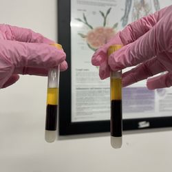 Phlebotomy Training Specialists - Serum
