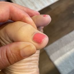 Uneven polish. Uneven polish.