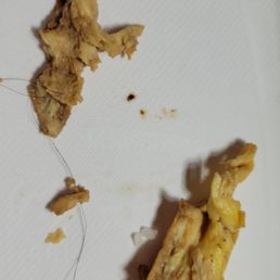 You  can see the hair was cooked into the eggs