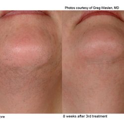 Maderma Medspa