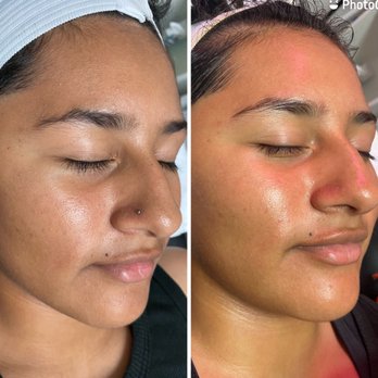 Karmas Beauty Bar - Microdermabrasion Facial - Skin Care Near Me - La puente, California Karmas Beauty Bar - Microdermabrasion Facial - Skin Care Near Me - La puente, California