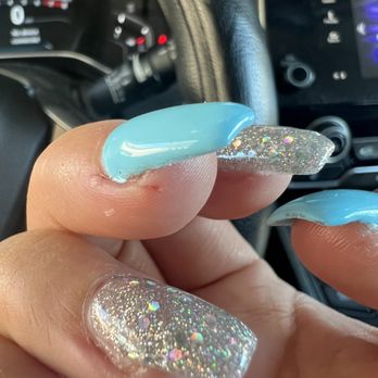 Color Nails - Burnt/cut through skin - Nail Salons Near Me - Las Vegas, Nevada Color Nails - Burnt/cut through skin - Nail Salons Near Me - Las Vegas, Nevada