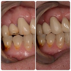 Chesterfield Hilltown Dental