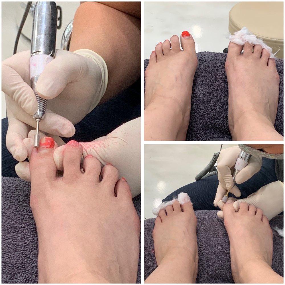 iFix Nails - Gentle removal of previous gel polish - Nail Salons Near Me - Georgetown, Kentucky iFix Nails - Gentle removal of previous gel polish - Nail Salons Near Me - Georgetown, Kentucky