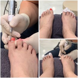 iFix Nails - Gentle removal of previous gel polish - Nail Salons Near Me - Georgetown, Kentucky