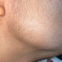 Zena Skin & Body Spa - I grew a beard from laser treatment with Salma.