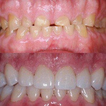 Adam Vaghari, DDS - Cosmetic Dentists Near Me - Laguna Niguel, California Adam Vaghari, DDS - Cosmetic Dentists Near Me - Laguna Niguel, California