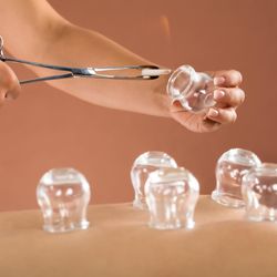 FM Acupuncture