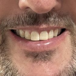 Juanita Family Dentistry - Before