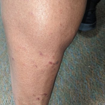 Azul Medspa - Laser Hair Removal Near Me - El Paso, Texas