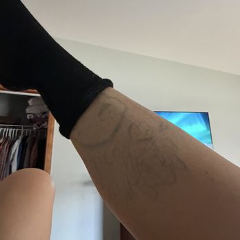 LaserAway - Unfinished work that was paid for! 80% of my $10,000 was serviced and then they scammed me telling me I had no more sessions left - Tattoo Removal Near Me - Fort Lauderdale, Florida LaserAway - Unfinished work that was paid for! 80% of my $10,000 was serviced and then they scammed me telling me I had no more sessions left - Tattoo Removal Near Me - Fort Lauderdale, Florida