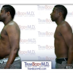 TrimBody M.D - Weight Loss Before and After