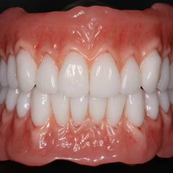 David Gelman's Dental Laboratory Inc - HIGH END 
BPS DENTURES