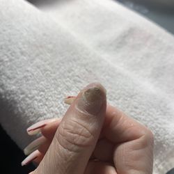 Oro Valley Hand & Foot Spa - Kelly - Fungus under my nails !!