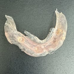 West Valley Dental - Soft relined came off after 6days