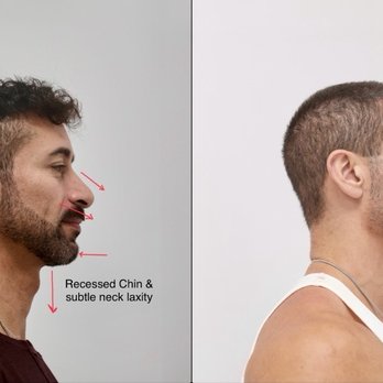 Karan Dhir, MD - Cosmetic Surgeons Near Me - Beverly Hills, California Karan Dhir, MD - Cosmetic Surgeons Near Me - Beverly Hills, California