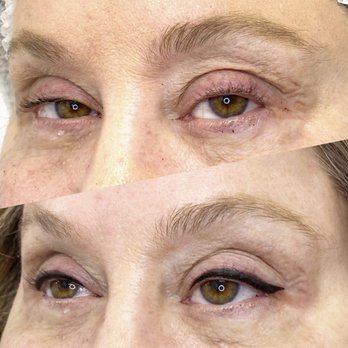 Esthetics by Yolanda  - Skin Care Near Me - Miami, Florida