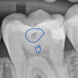 MCHD Dentistry