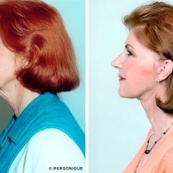 Personique Plastic Surgery Center