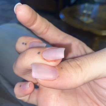 T3 Nails - Side of my nail where my skin was cut off. This finger had so much blood around it. - Nail Salons Near Me - Union City, California