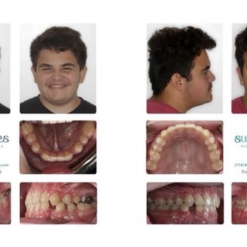 Bloomfield Dental Center - General Dentistry Near Me - Cerritos, California Bloomfield Dental Center - General Dentistry Near Me - Cerritos, California
