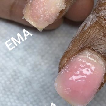 Bella Nails & Spa - MMA sticks like superglue and can really damage your natural nails. You want clumpy when removing, not sticky. - Nail Salons Near Me - Oxnard, California