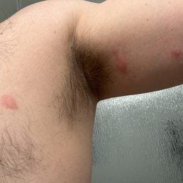 Next day after finding bugs in the showers