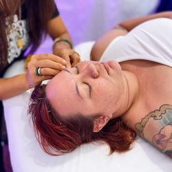Moon Gate Acupuncture at Unity Wellness - Facial rejuvenation acupuncture