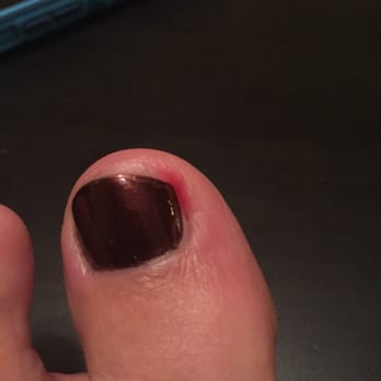 Concept Nail - Damage done at Concept Nail. Skin was clipped with nail (which I asked to not be cut and was cut anyway). It is now infected. - Nail Salons Near Me - Woodbridge, Virginia Concept Nail - Damage done at Concept Nail. Skin was clipped with nail (which I asked to not be cut and was cut anyway). It is now infected. - Nail Salons Near Me - Woodbridge, Virginia