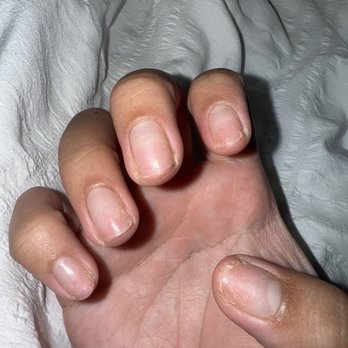 Elite Nails & Lash - Thin, sensitive, brittle nails after manicure here - Nail Salons Near Me - La Mesa, California Elite Nails & Lash - Thin, sensitive, brittle nails after manicure here - Nail Salons Near Me - La Mesa, California