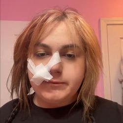 Canyon Hills High School - This was My daughter after these group of boys fought her and broke her nose. Wow. Disappointed