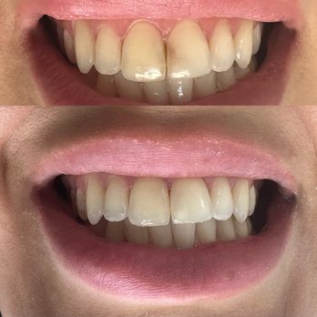 Farzad Dental - Look at that difference! - Cosmetic Dentists Near Me - Encino, California Farzad Dental - Look at that difference! - Cosmetic Dentists Near Me - Encino, California