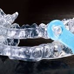 Wise Dental Care - We offer safe and effective sleep apnea appliances for people who can't use a CPAP.